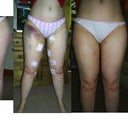 before, week after,2months after